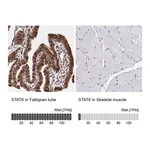 Atlas Antibodies Anti-STAT6 Antibody