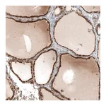 Atlas Antibodies Anti-STC1 Antibody