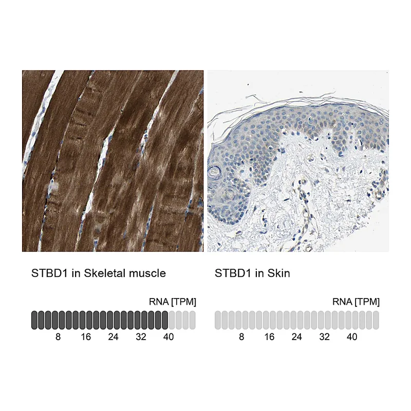 Atlas Antibodies Anti-STBD1 Antibody