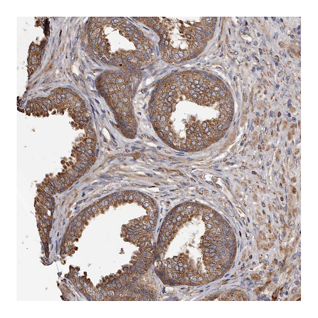 Atlas Antibodies Anti-STEAP2 Antibody