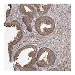 Atlas Antibodies Anti-STEAP2 Antibody