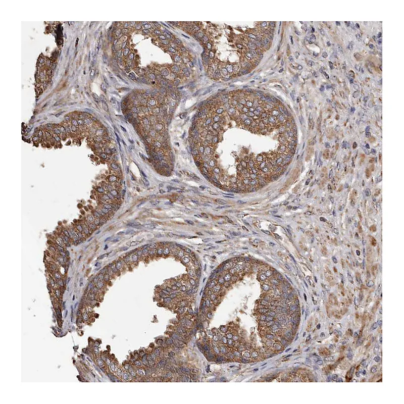 Atlas Antibodies Anti-STEAP2 Antibody