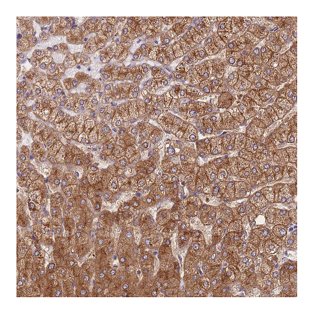 Atlas Antibodies Anti-STEAP3 Antibody