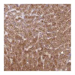 Atlas Antibodies Anti-STEAP3 Antibody