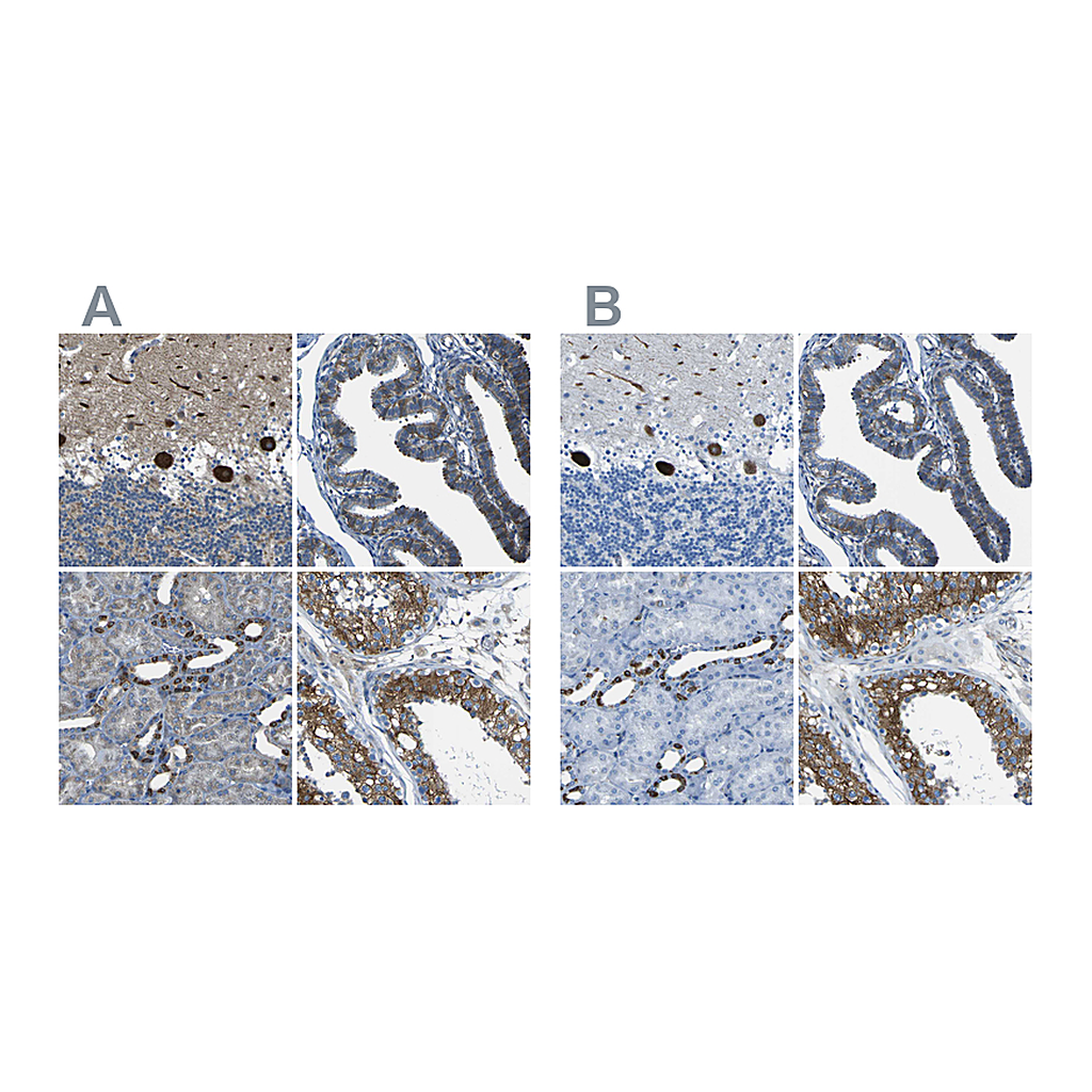 Atlas Antibodies Anti-STIM1 Antibody