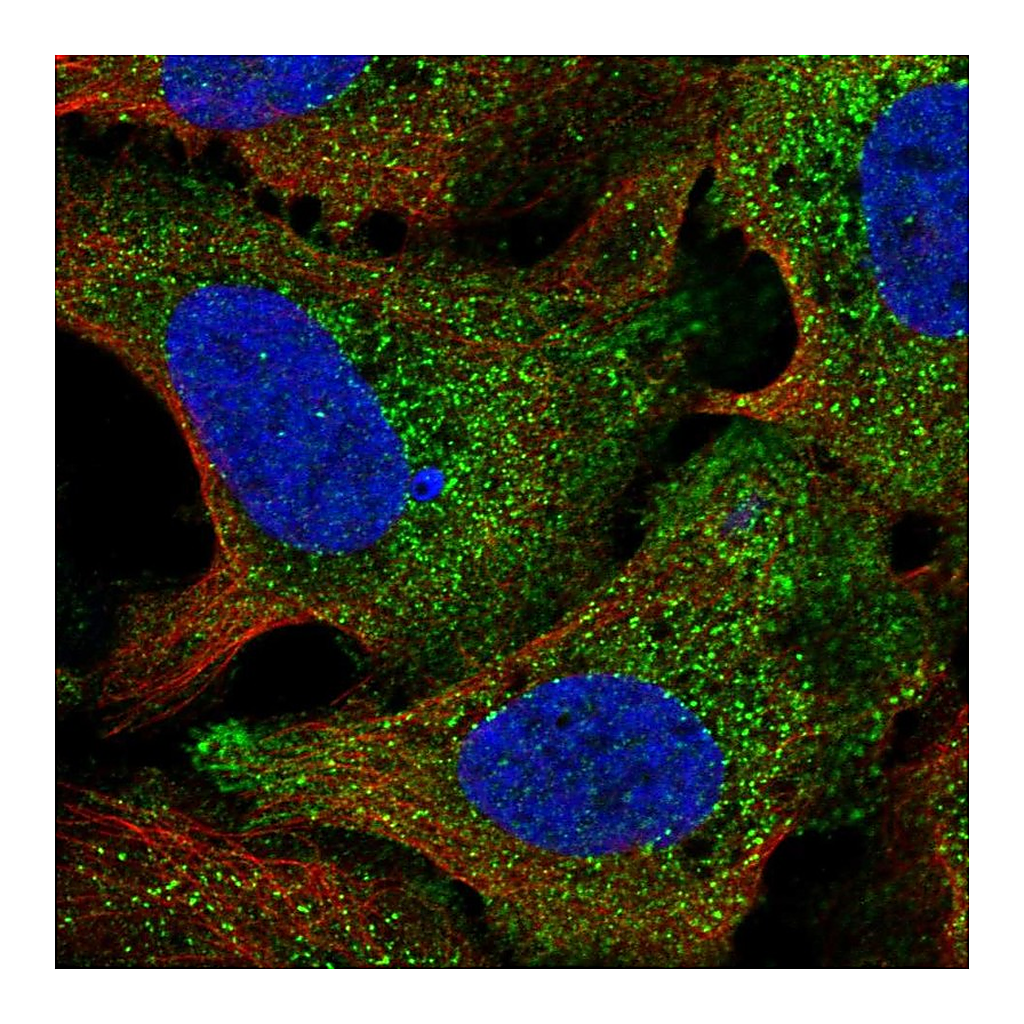 Atlas Antibodies Anti-STIL Antibody