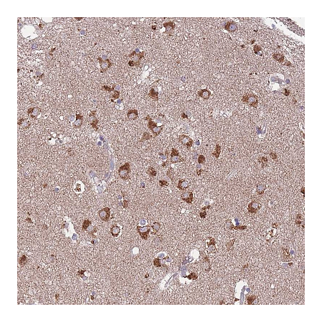 Atlas Antibodies Anti-STIM2 Antibody