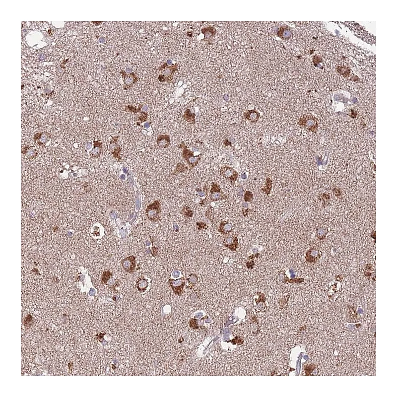 Atlas Antibodies Anti-STIM2 Antibody