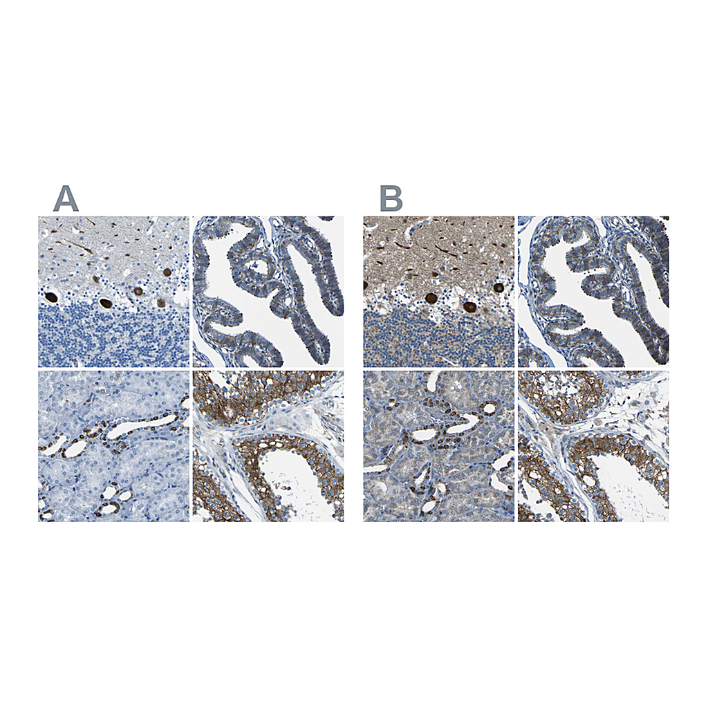 Atlas Antibodies Anti-STIM1 Antibody