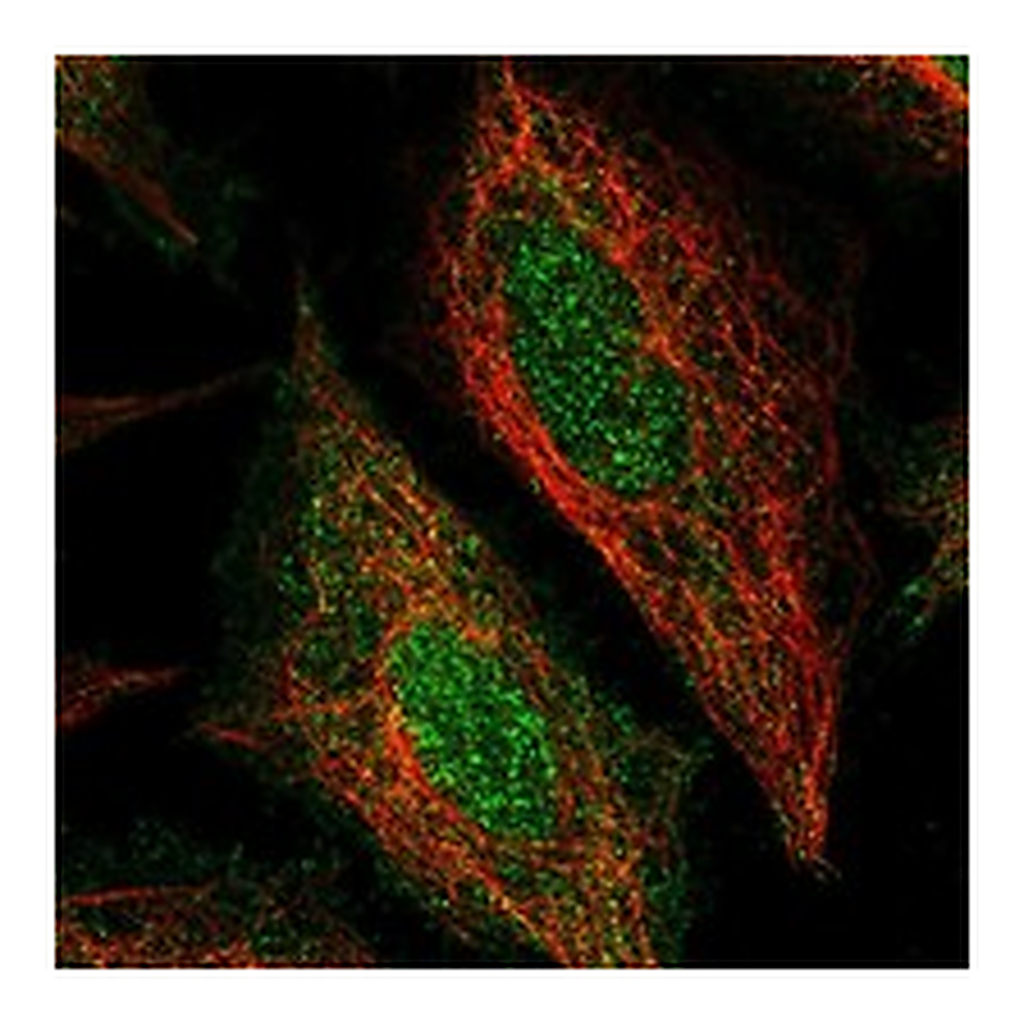 Atlas Antibodies Anti-STEAP4 Antibody