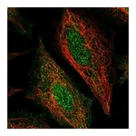 Atlas Antibodies Anti-STEAP4 Antibody