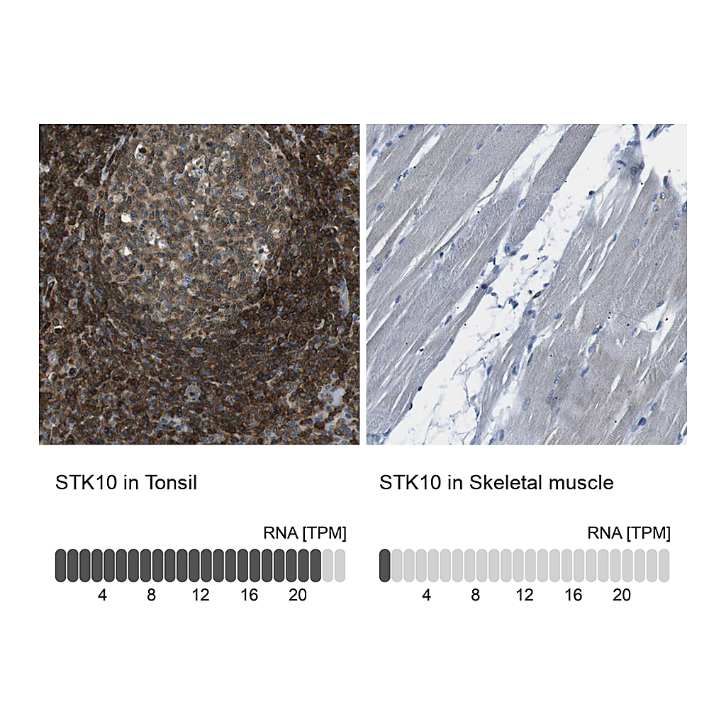 Atlas Antibodies Anti-STK10 Antibody