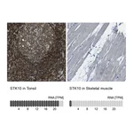 Atlas Antibodies Anti-STK10 Antibody