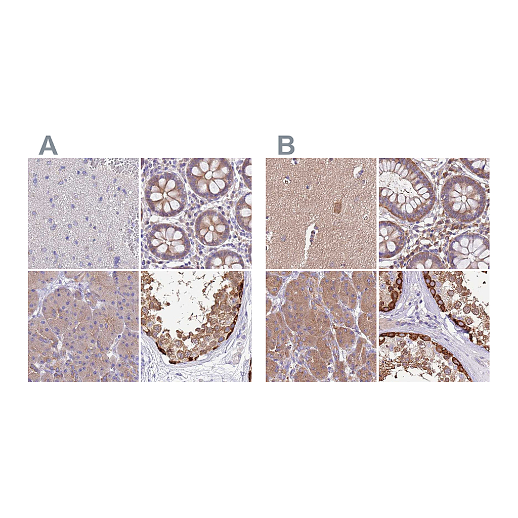 Atlas Antibodies Anti-STIP1 Antibody