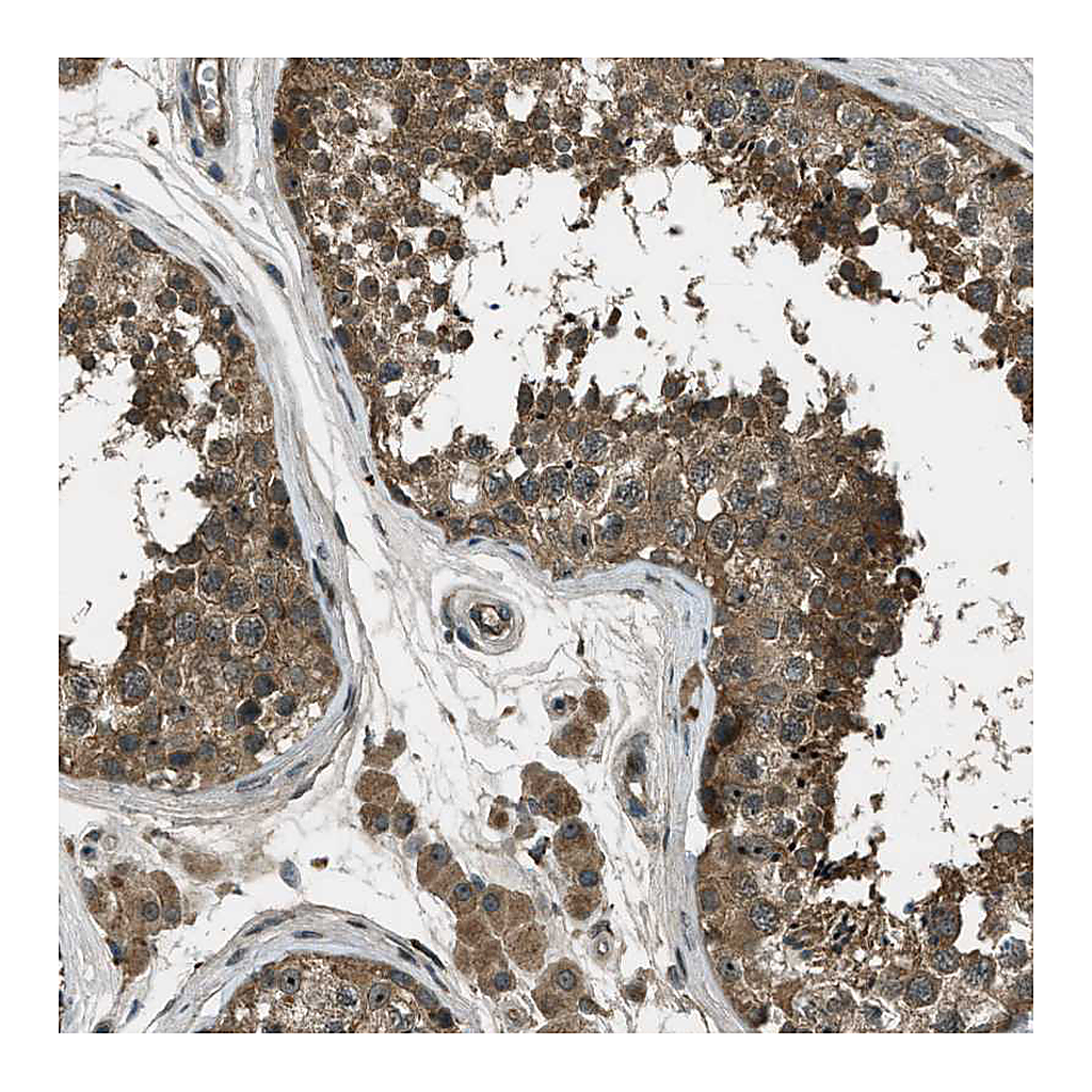 Atlas Antibodies Anti-STK11 Antibody