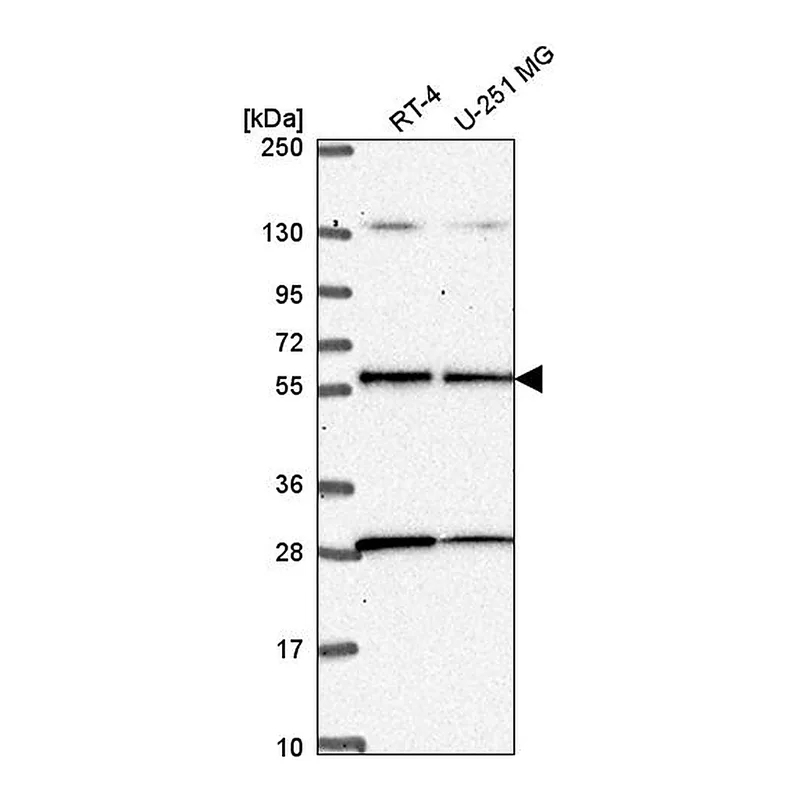 Atlas Antibodies Anti-STK11 Antibody