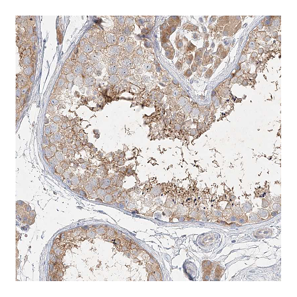 Atlas Antibodies Anti-STK11IP Antibody
