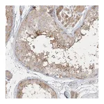 Atlas Antibodies Anti-STK11IP Antibody