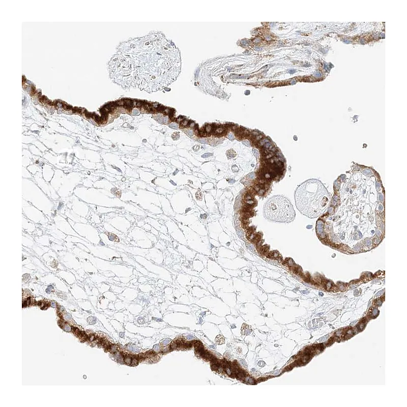 Atlas Antibodies Anti-STK11IP Antibody