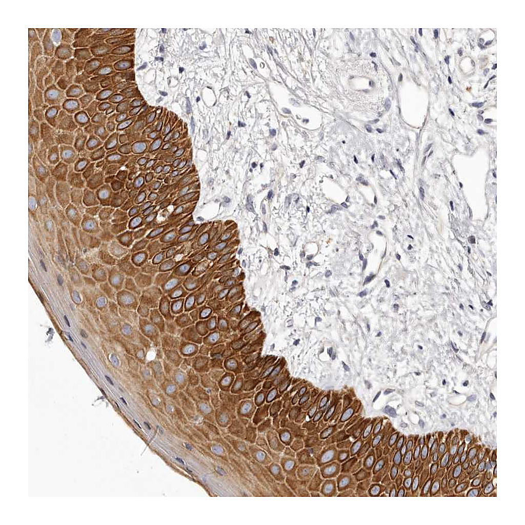 Atlas Antibodies Anti-STK16 Antibody
