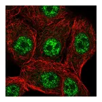 Atlas Antibodies Anti-STK19 Antibody