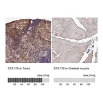 Atlas Antibodies Anti-STK17B Antibody