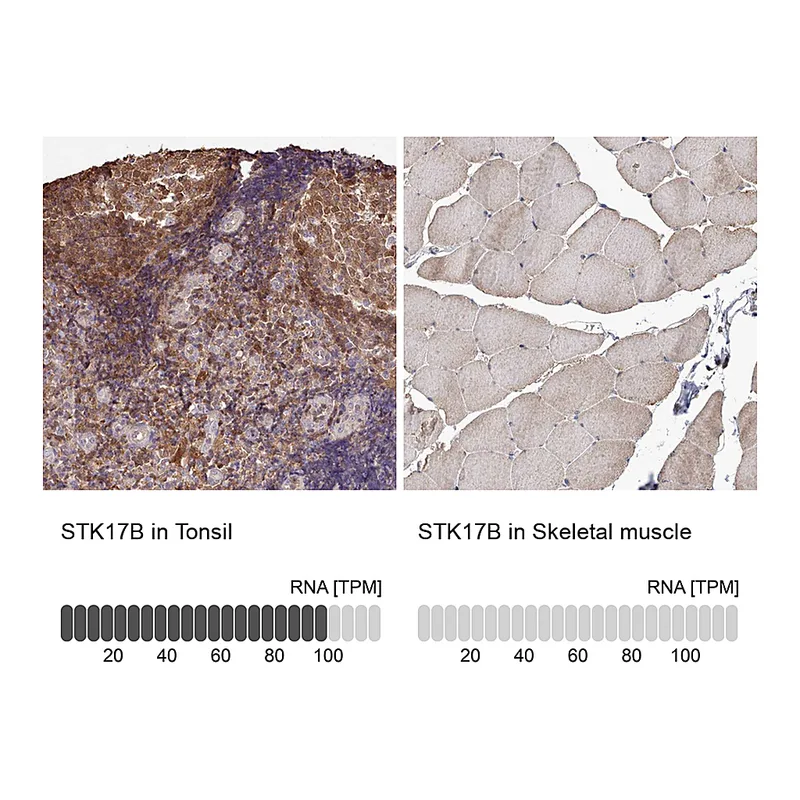 Atlas Antibodies Anti-STK17B Antibody