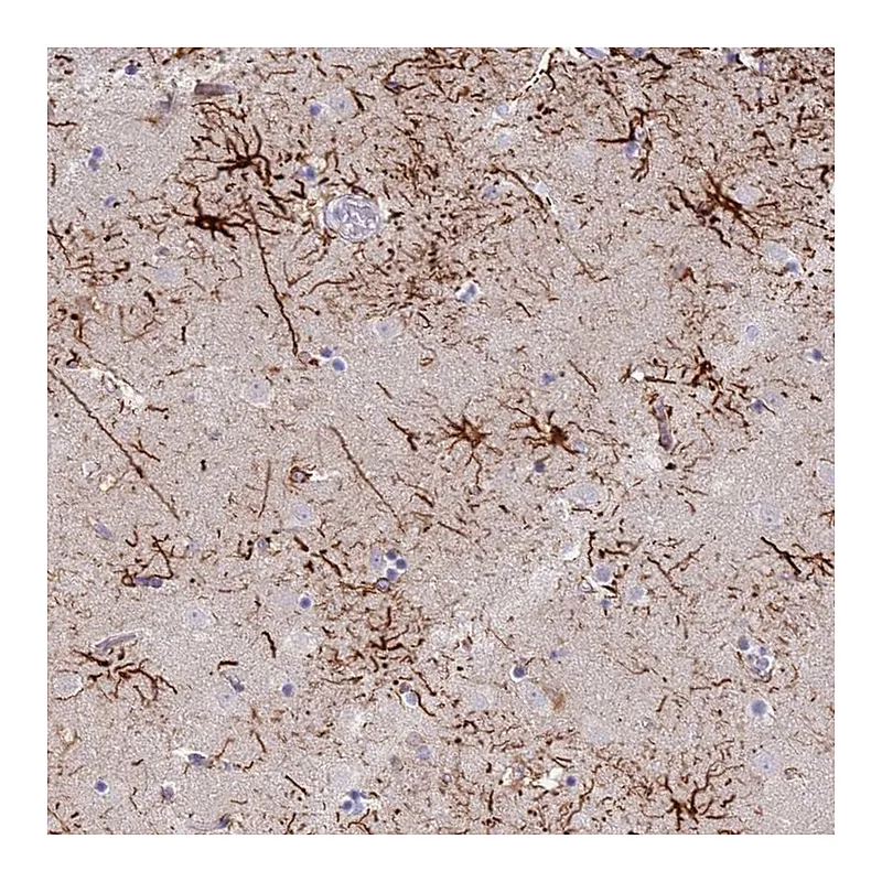 Atlas Antibodies Anti-STK25 Antibody
