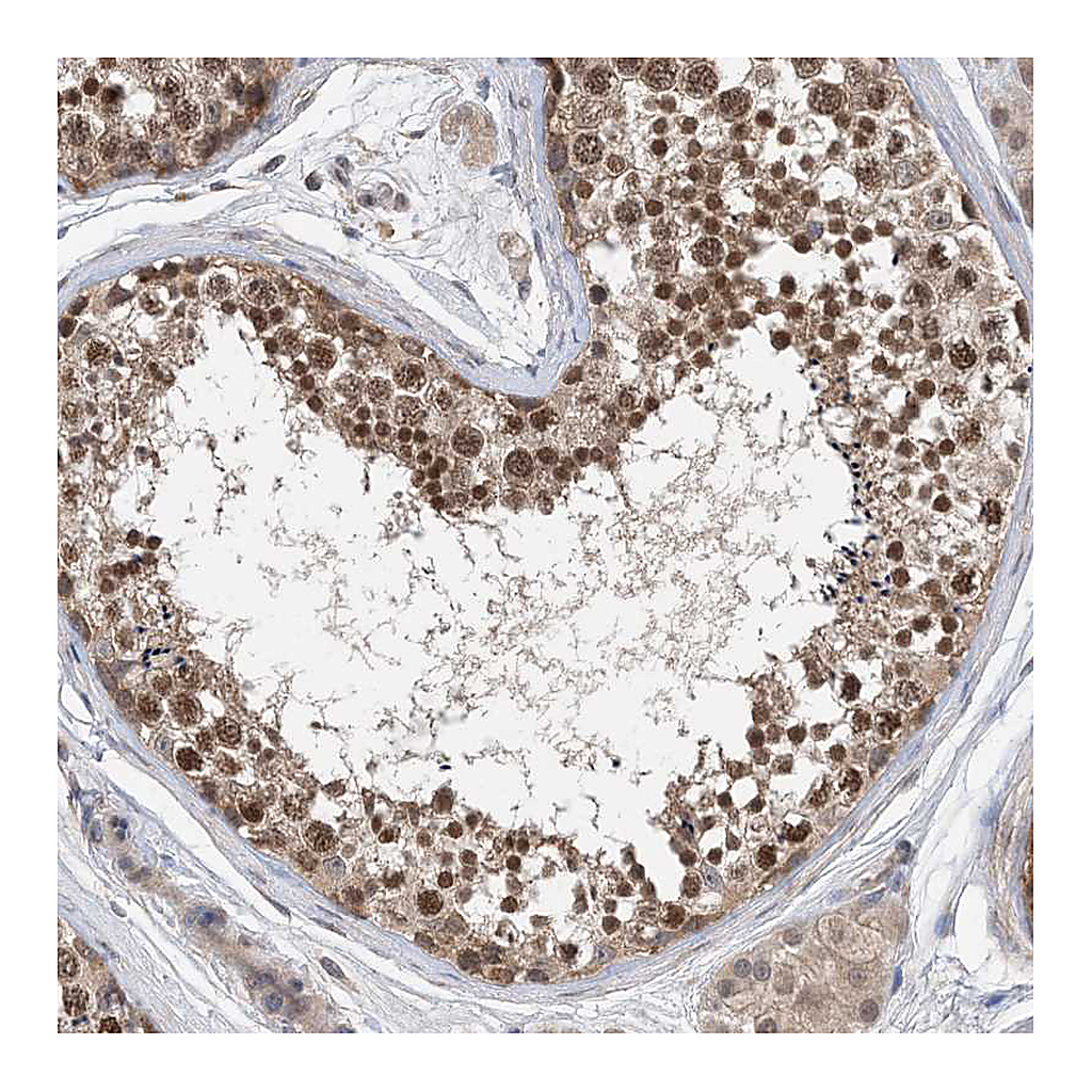 Atlas Antibodies Anti-STK19 Antibody