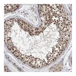 Atlas Antibodies Anti-STK19 Antibody