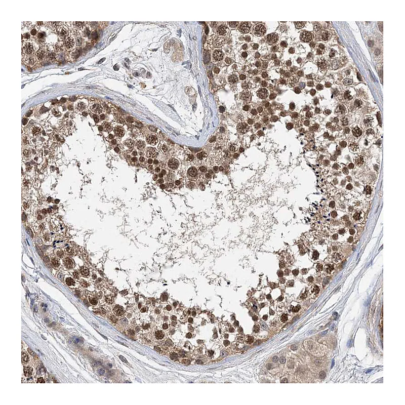 Atlas Antibodies Anti-STK19 Antibody