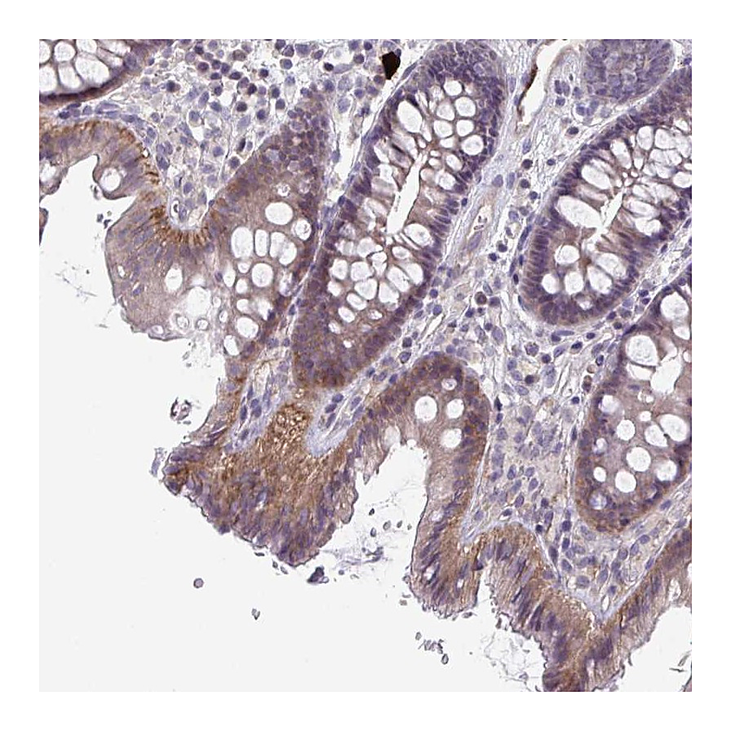Atlas Antibodies Anti-STK26 Antibody