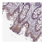 Atlas Antibodies Anti-STK26 Antibody