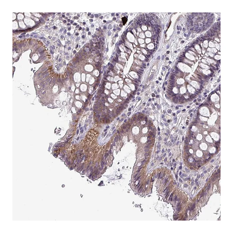 Atlas Antibodies Anti-STK26 Antibody