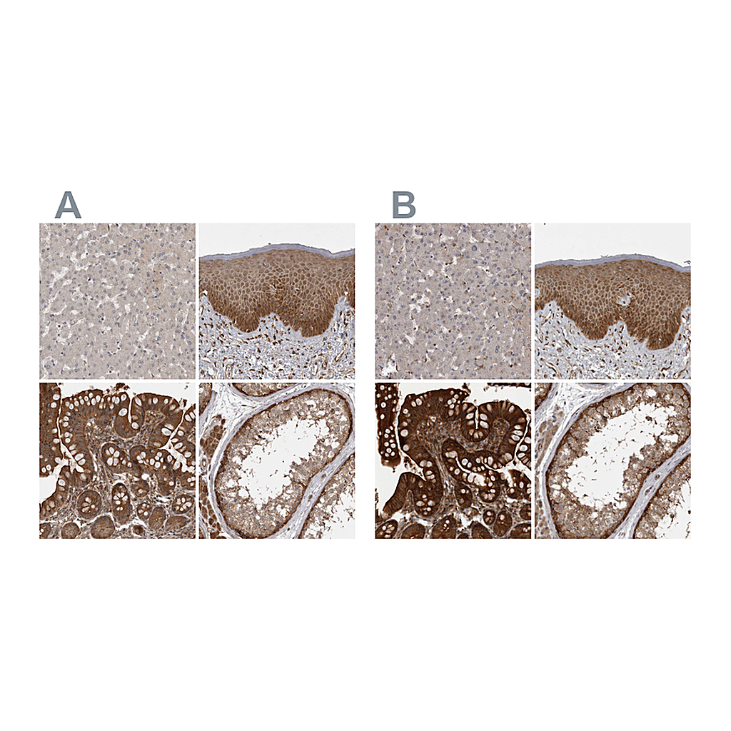 Atlas Antibodies Anti-STK24 Antibody