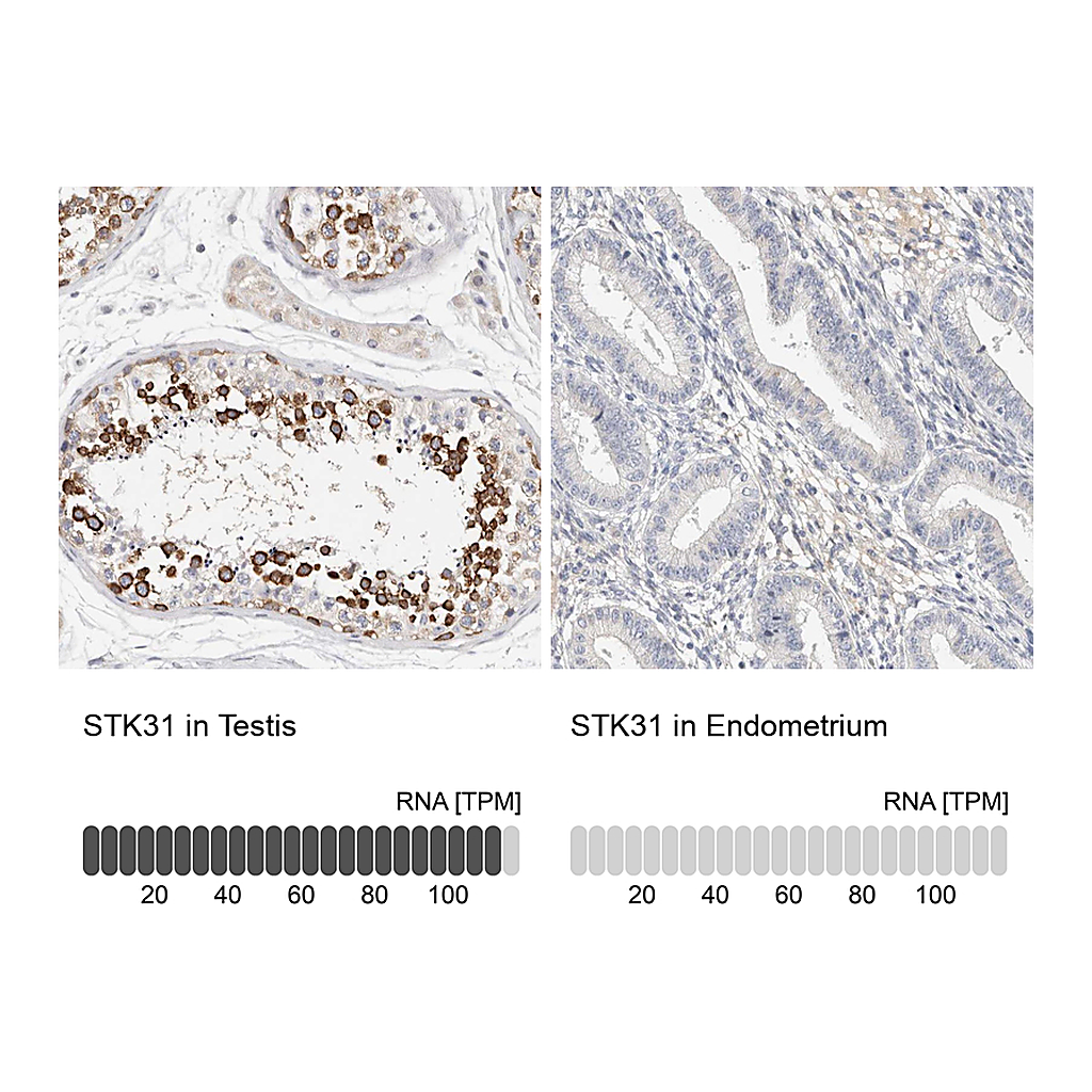 Atlas Antibodies Anti-STK31 Antibody
