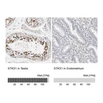 Atlas Antibodies Anti-STK31 Antibody