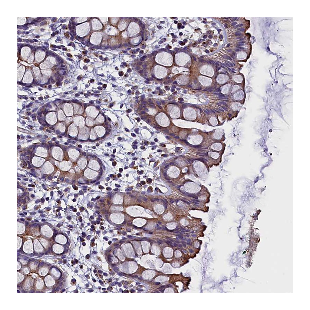Atlas Antibodies Anti-STK32A Antibody