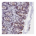 Atlas Antibodies Anti-STK32A Antibody