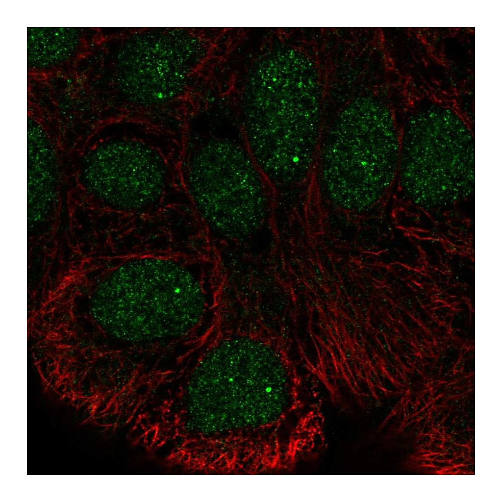Atlas Antibodies Anti-STK35 Antibody