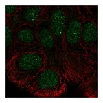 Atlas Antibodies Anti-STK35 Antibody