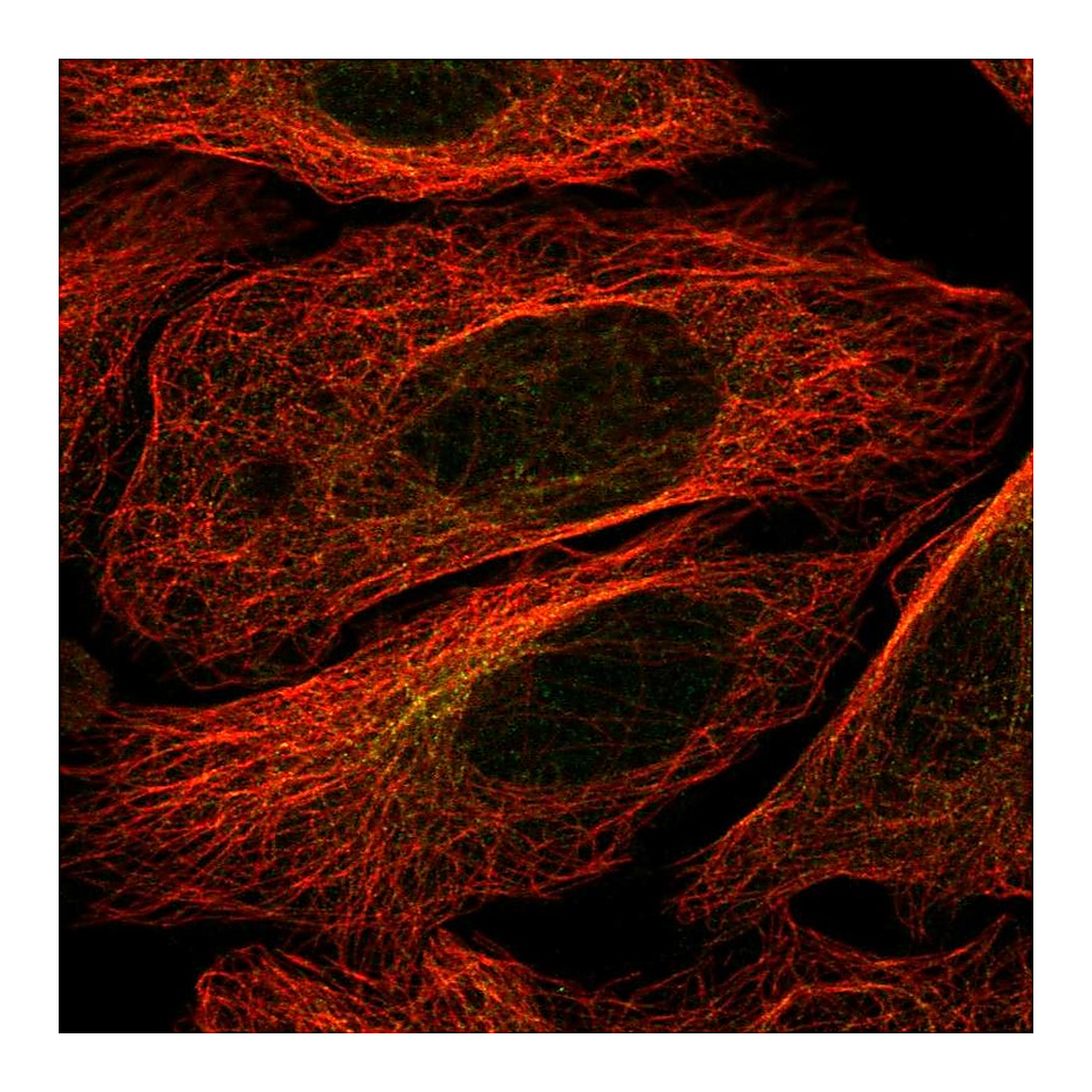 Atlas Antibodies Anti-STK32B Antibody