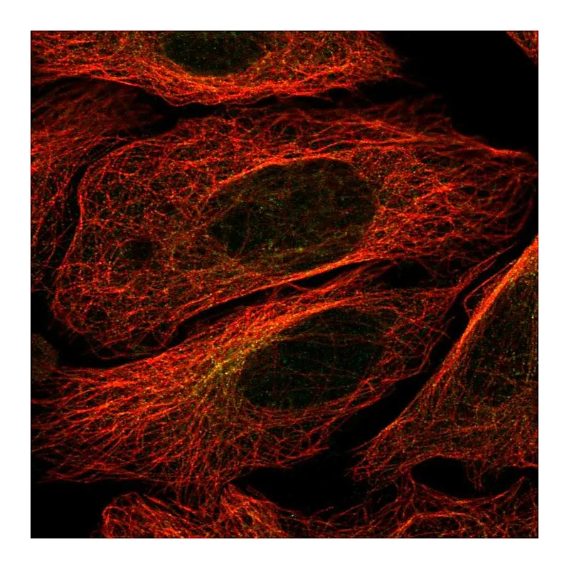 Atlas Antibodies Anti-STK32B Antibody