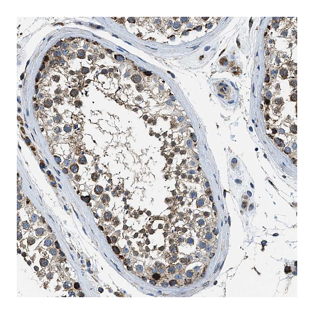 Atlas Antibodies Anti-STK33 Antibody