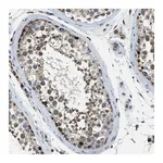 Atlas Antibodies Anti-STK33 Antibody