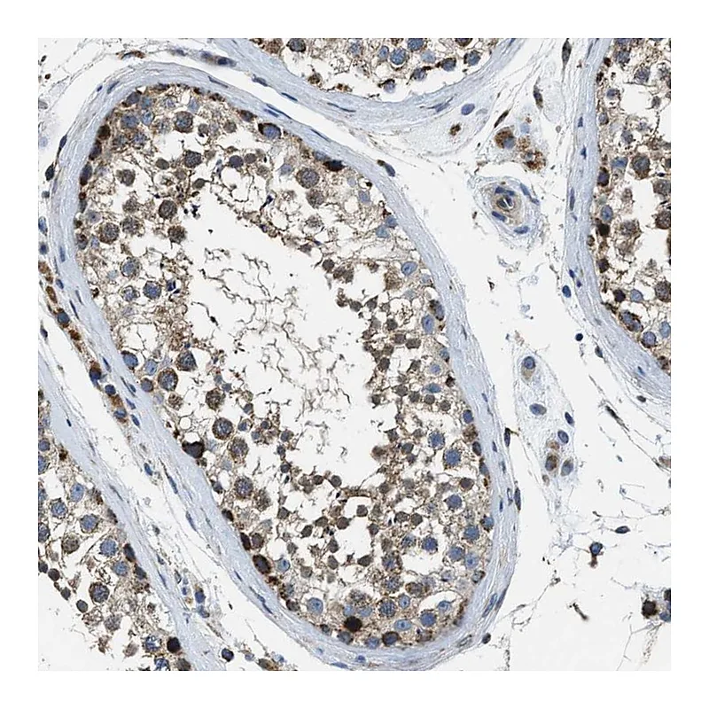 Atlas Antibodies Anti-STK33 Antibody