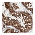 Atlas Antibodies Anti-STK36 Antibody