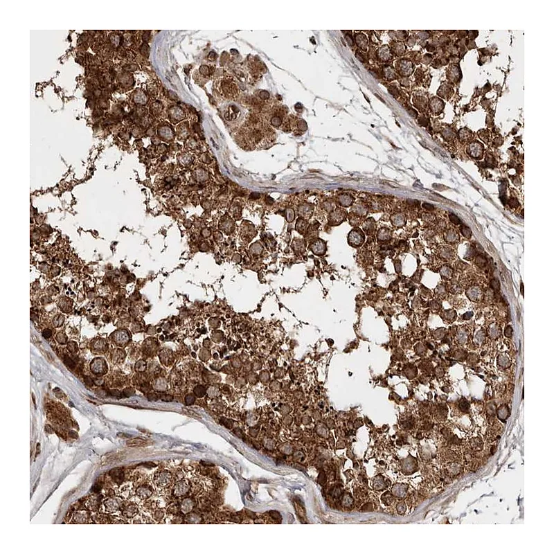 Atlas Antibodies Anti-STK36 Antibody