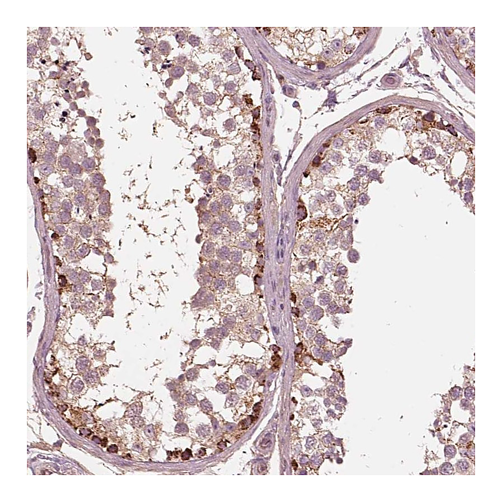 Atlas Antibodies Anti-STK33 Antibody