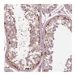 Atlas Antibodies Anti-STK33 Antibody